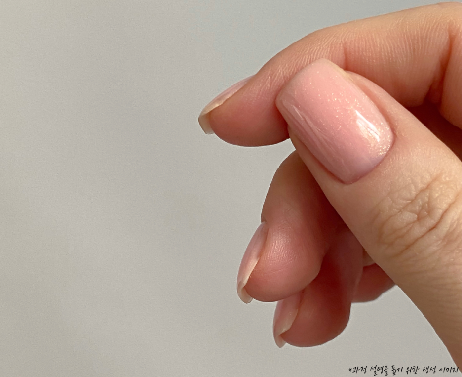 미사 라미네이트, 무삭제 라미네이트 아르네이트가 치아를 덜 깎아도 되는 과학적 이유 1 <의사 설명> 3