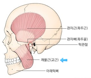 미사치과의원, 이갈이가 두통,목 결림까지 만드는 이유 3가지 <전문의 작성> 6