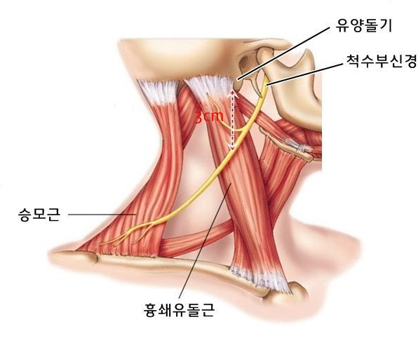 미사치과의원, 이갈이가 두통,목 결림까지 만드는 이유 3가지 <전문의 작성> 8
