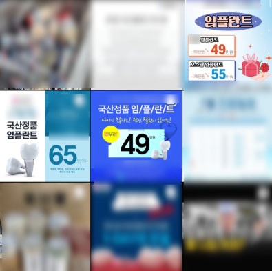 미사 치과, 임플란트 39만원 정말 괜찮을까요? (비용·가격) 1