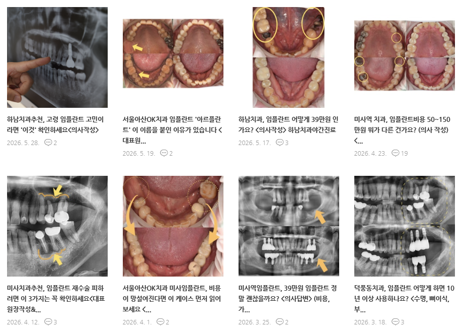 하남임플란트 잘하는곳, 의사가 생각하는 중요한 조건 3가지 11