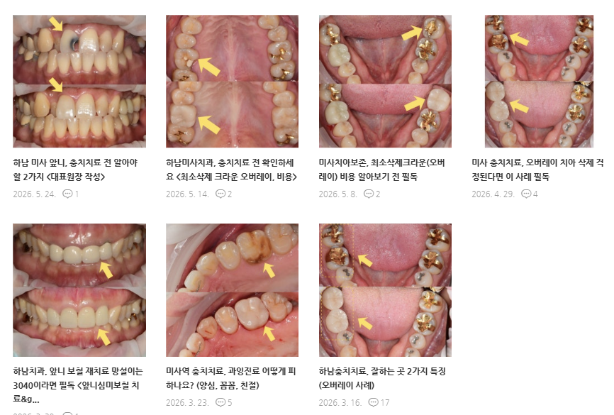 하남치과 어금니 크라운 치료, 상담 전 확인해야 할 핵심 2가지 <대표원장 작성> 8