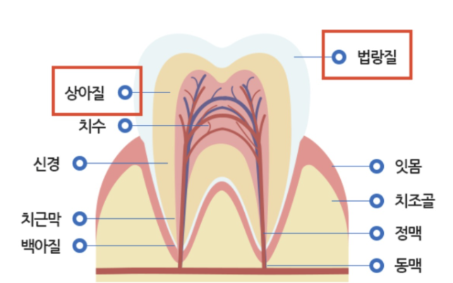 하남미사치과 충치치료, 충치가 깊다고 무조건 신경치료일까요? [대표원장 작성] 8