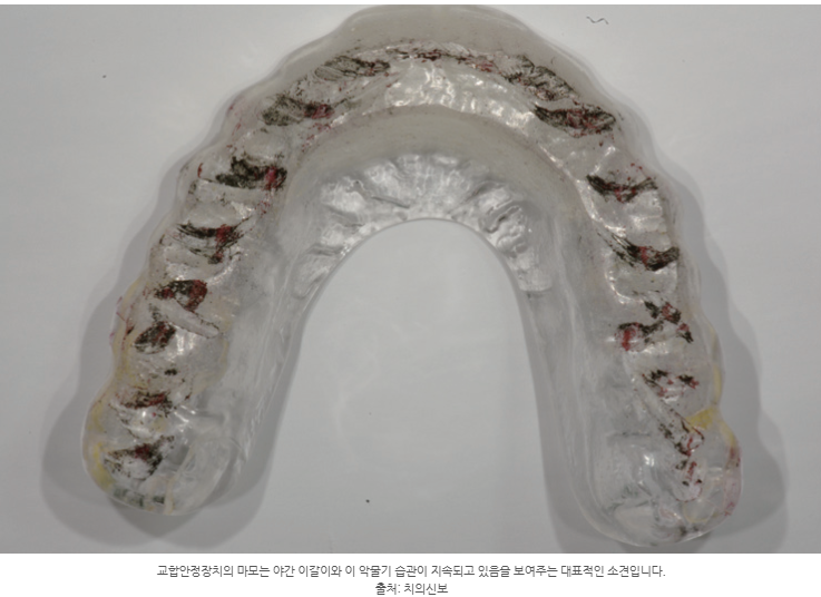 하남미사턱관절치과, 자고 일어나면 턱이 아픈 이유와 치료 방법 <의사 작성> 2